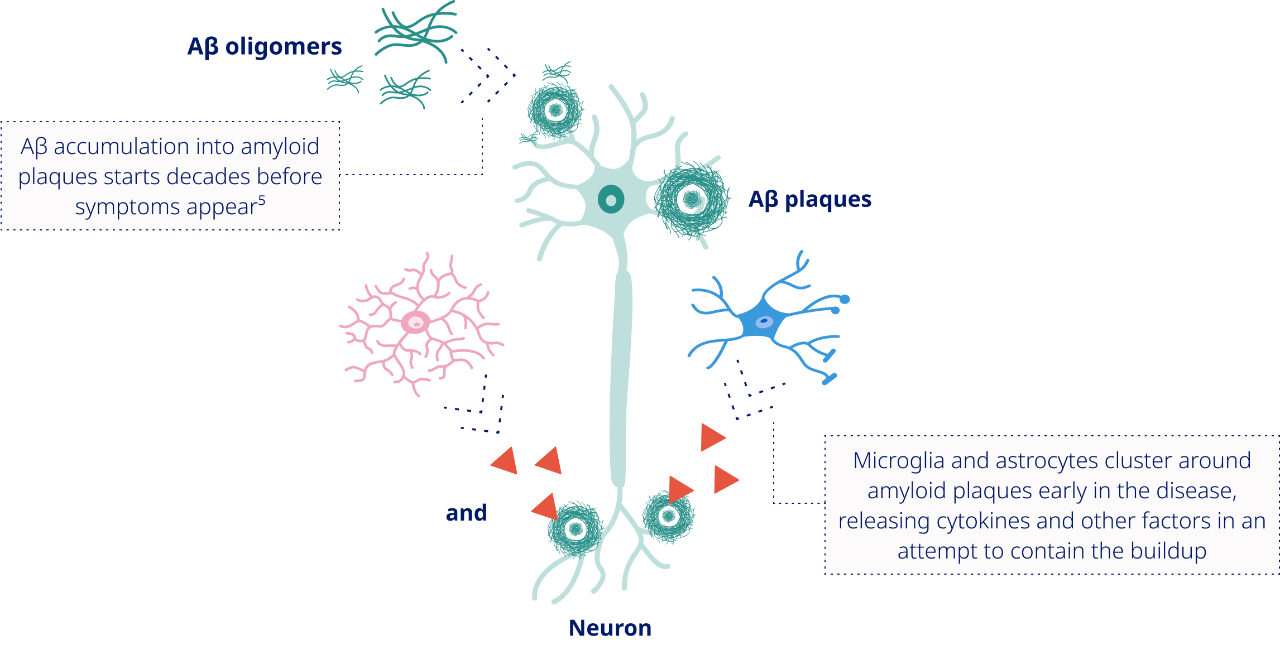 Initial Inflammatory Response infographic